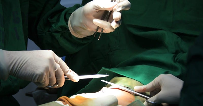 Will An Urgent Care Remove A Cyst
